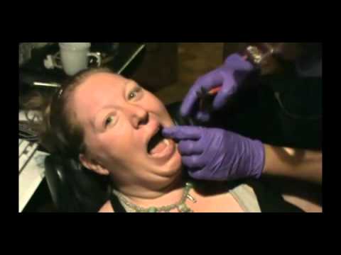 dental fetish - pulling teeth improve style, torture fetish...i really enjoyed this!! http://www.firstclassclowns.com http://www.criminalupload.com.