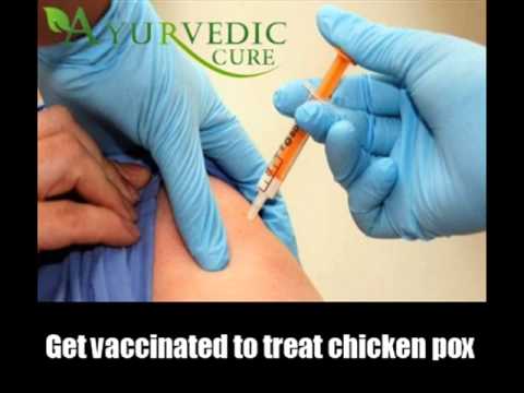 how to avoid chicken pox