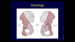 Acetabulum fracture anatomy (OTA lecture series III v04a)