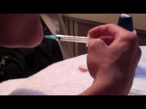how to drain ears after a cold