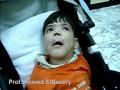 Dandy walker syndrome Pediatric Dentistry
