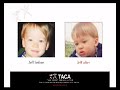 Talk About Curing Autism Video