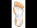 Does your heel hurt?
