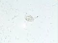 Rotifer, Colurella obtusa.wmv