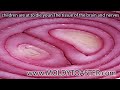 children are at to die youn The tissue of the brain and ner.mov