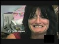 Lymphedema disease    (wow)