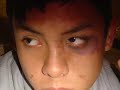 Teen Dating Violence