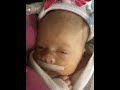 Off CPAP video