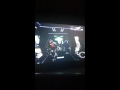 Fracture Disappearing Head Glitch