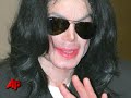 Michael Jackson's arms were covered...