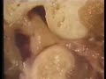 Pathology: Normal TMJ Pathology: Normal TMJ