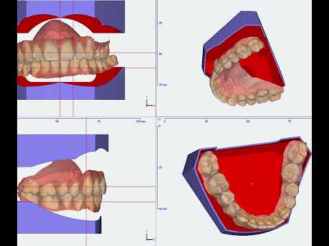 3D DRUCK Modell Sockel