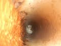 Black Mold In The Attic Black Mold In The Attic