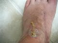 My Foot