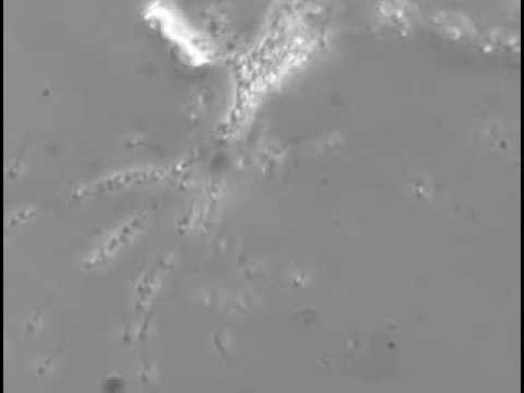 SPERM-CERVICAL MUCUS INTERACTION