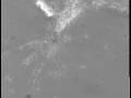 SPERM IN CERVICAL MUCUS