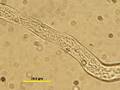 Cytoplasmic Streaming in Pollen Tube