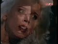 Lexx Eating Patterns: Lazy Eye