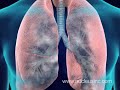 2008 Nucleus 3D Medical Animation Demo Reel 2008 Nucleus 3D Medical Animation Demo Reel