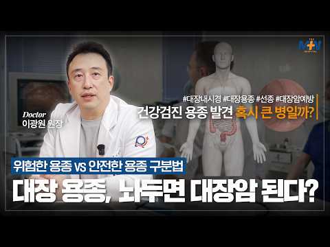 건강검진에서 대장내시경으로 발견한 용종, 놔두면 대장암 된다? 위험한 용..