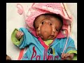 Baby born with four eyes, two mouths and two faces Baby born with four eyes, two mouths and two faces
