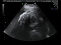 29-Week Ultrasound