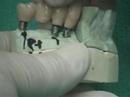 Path of Insertion