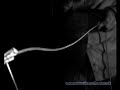 Transverse wave travel along a bungee cord
