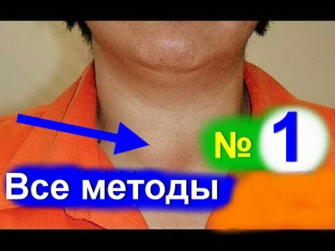 Как лечить кисту на щитовидке народными средствами Как лечить кисту на щитовидке народными средствами