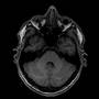my brain (mri scan)