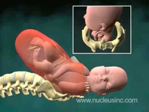 PROSES PENURUNAN KEPALA DAN KELAHIRAN BAYI PROSES PENURUNAN KEPALA DAN KELAHIRAN BAYI