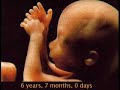 Autism Research and Prenatal Testing