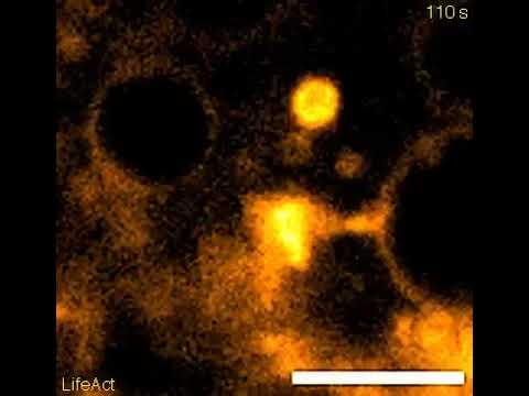 הדמעות לא זולגות מעצמן