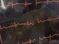 EMT, Paramedic, and Fire video from White Rose Ambulance