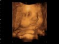 heather and khaid 4d baby scan