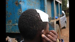 Image result for brutalized boy in Nyeri
