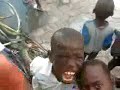 Buya.org - Burn Scared Child in Cite Soleil, Haiti
