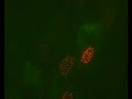 Infection of EYFP-PML I HF cells by vECFP-ICP4 HSV1