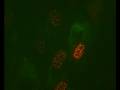 Infection of EYFP-PML I HF cells by vECFP-ICP4 HSV1
