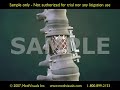 3D Medical Animation: Thoracolumbar Spinal Fusion