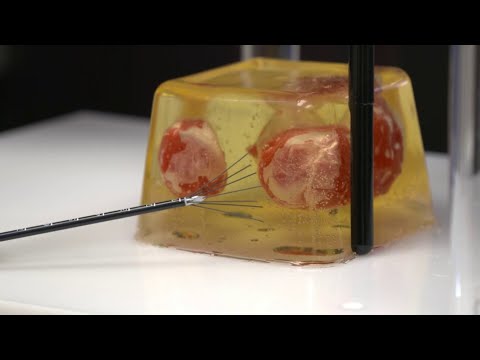 video-linktoworks-Treating Fibroids with Heat