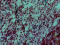 Medical Treatment by Stem Cells Myth or Reality? Episode 1