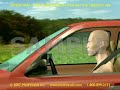 2D/3D Medical Animation: TBI - Traumatic Brain Injury Part I