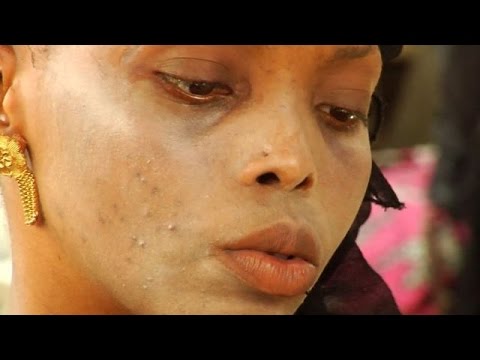 Trotz Bleichmittel-Verbot: Helle Haut um jeden Preis