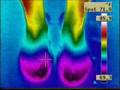 thermographics
