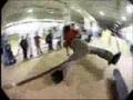Skateboard blunders