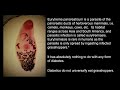 critical analysis of the cure for all disease
