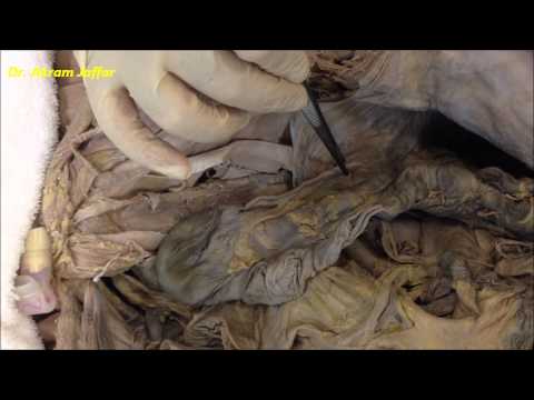 how to locate appendix