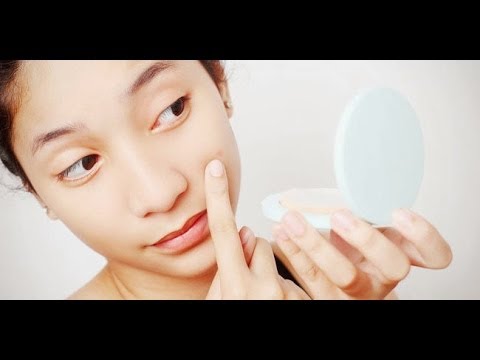 How to remove acne scars