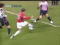 buffon